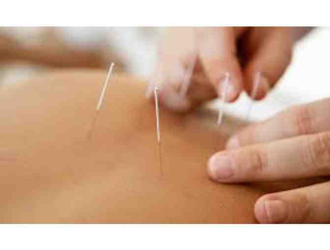 Embody Acupuncture - 1 Acupuncture Treatment by Emily Bunning, L.Ac.