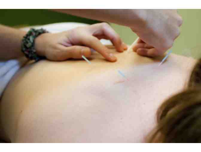 Community Acupuncture Session at Gateway Body Works