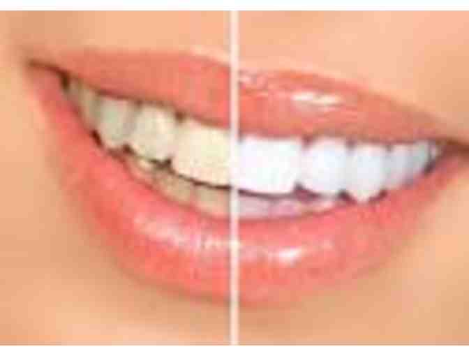 60-minute Teeth Whitening Session from Smiling Bright