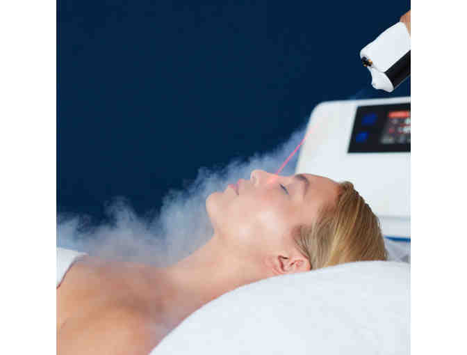 CryoFacial Therapy - 3 sessions Package