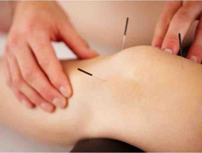 Alma Acupuncture