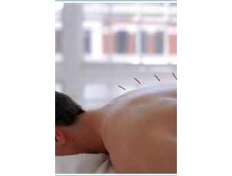 Acupuncture Session and Consultation