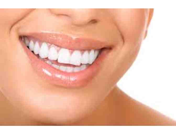 SMILES DENTAL GROUP- Teeth Whitening