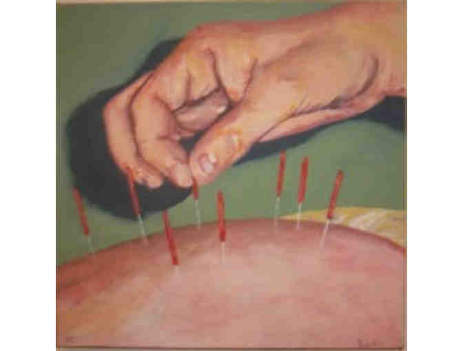 Acupuncture by Meret