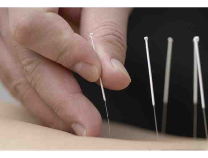 Acupuncture or Naturopathic Visit, Kapaa with Dr. Leia Melead