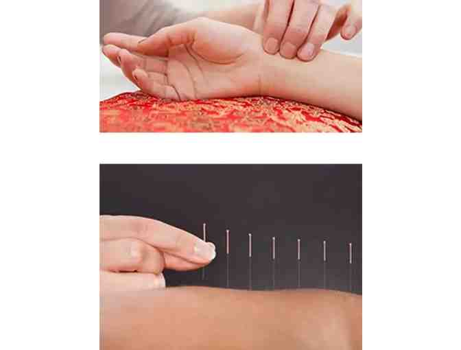 Acupuncture, Evaluation, Treatment, Rose Gold Health product