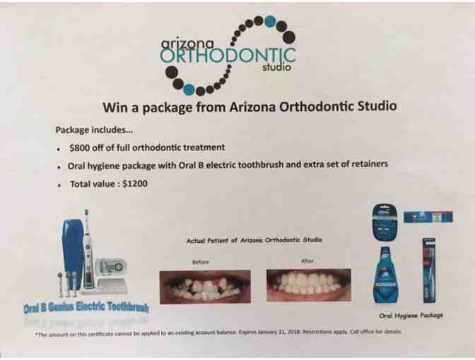 Arizona Orthodontic Studio- Oral B Toothbrush/Gift Basket/$800 off full ortho treatment