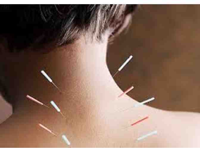 Acupuncture for Humans: One Session