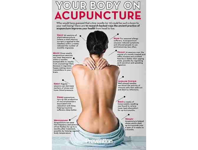 1 initial acupuncture treatment & 2 follow up treatments at Eastside Family Acupuncture