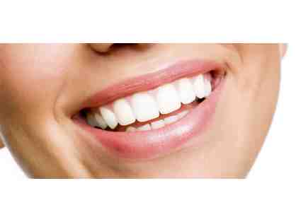 Gift Certificate for a Take Home Teeth Whitening Kit