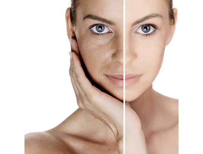 PURE LUXE MEDICAL SKIN RESUREFACING LASER WITH SKIN CONSULTATION