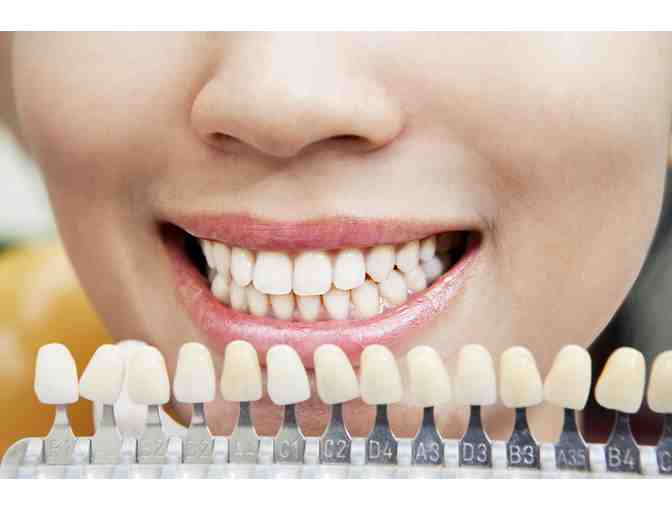 Organic Tans & Teeth Whitening: Teeth Whitening