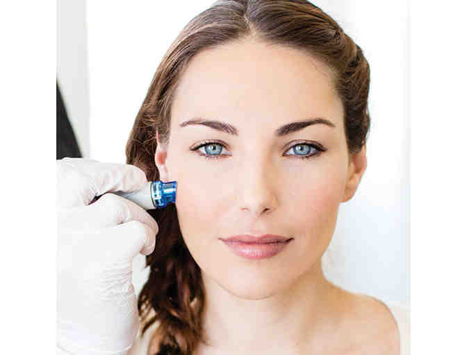 HydraFacial MD Treatment