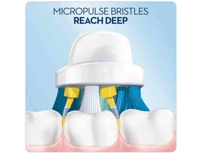 Oral B Vitality Electric Toothbrush from Granite Coast Orthodontics