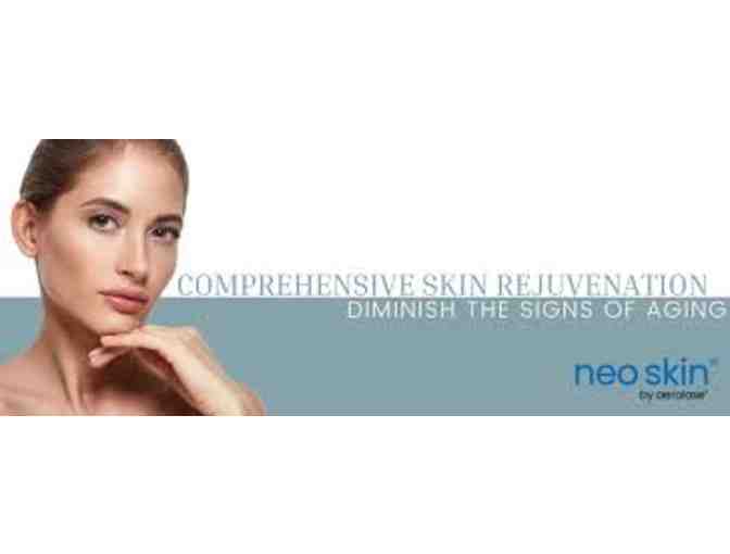 NeoSkin Rejuvination Treatment by Aerolase (package of 4)