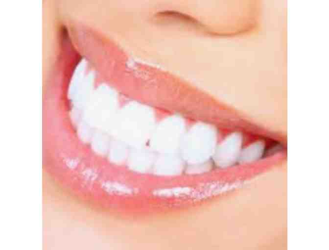 Vital Dental Aesthetics: Teeth Whitening (After X-ray, exam & cleaning) - Photo 1