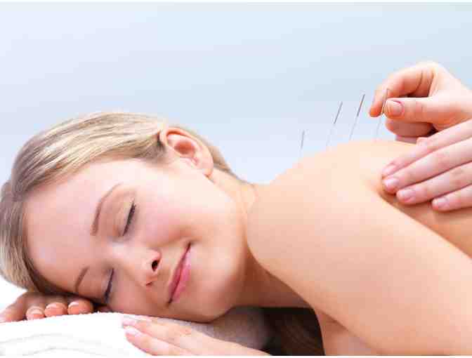 Acupuncture Massage Treatment at Compassionate Healing