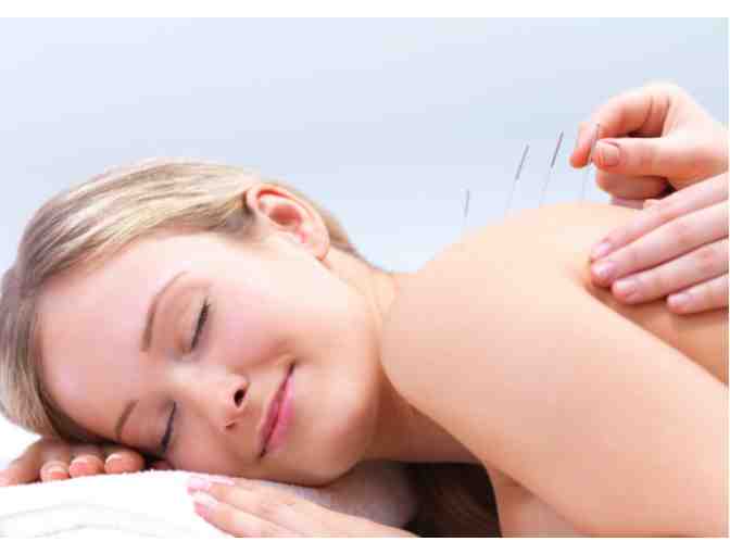 Acupuncture-Et-Al: Initial Accupuncture Treatment Session