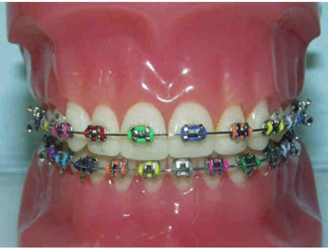 Palm Beach Orthodontics - $1500 towards 'Comprehensive Orthodontic Treatment'