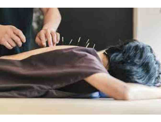 Candise Yang Acupuncture: $275 gift certificate - Photo 2