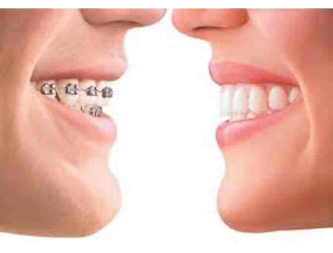 Newhart Orthodontics - Phase 1 Orthodontics Treatment for children