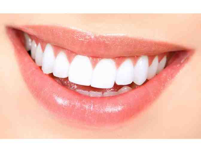 Moab Dental Health Center - Cosmetic Teeth Whitening